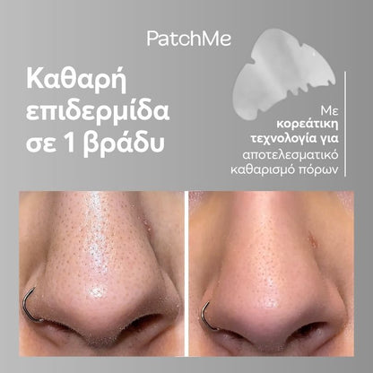 NOSE PATCHES